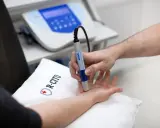 Fizjoterapeuta wykonuje zabieg laserem na dłoni pacjenta.