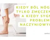 Kobieta trzyma się za łydkę, odczuwając ciągły ból nóg i zmęczenie. Czy to tylko przemęczenie, czy sygnał problemów naczyniowych?